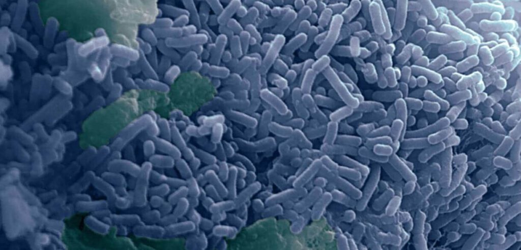 image of Limosilactobacillus reuteri